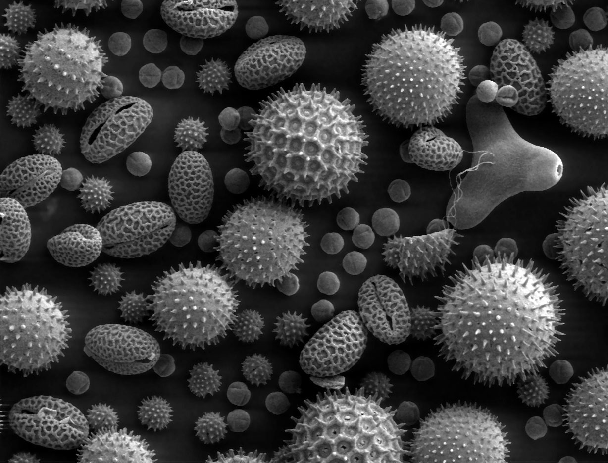Pollen grains as seen through an electronic microscope