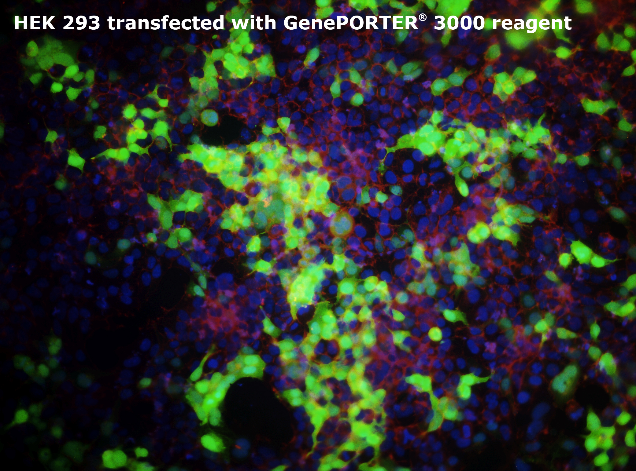 In vitro реагент. Hek 293 Сеномикс. Добавка Hek 293. Нек293 пищевая. Hek клетки.